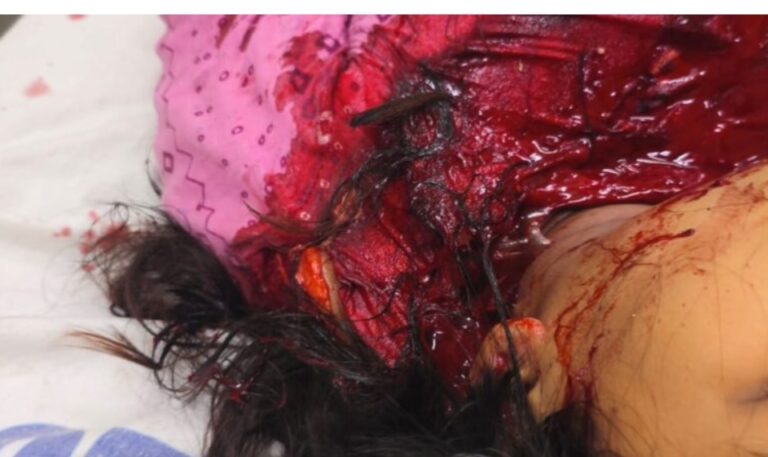 तीनों बहनों के ऊपर प्राणघातक हमला करने वाला आरोपी हुआ गिरफ्तार, पूछताछ के बाद होगा खुलासा